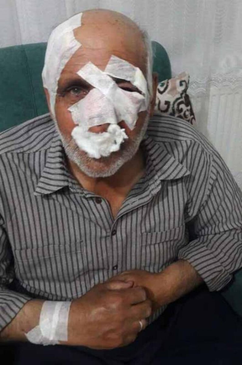 Gaziantep te köpeklerin saldırısına uğramıştı; 54 günlük yaşam mücadelesini kaybetti #3