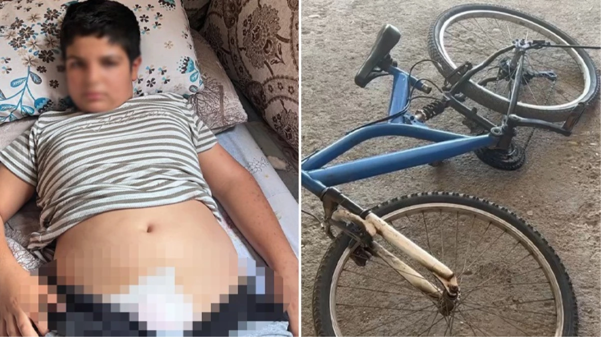 Bisiklet sürerken başıboş sokak köpeklerinin saldırısına uğrayan çocuk yaralandı
