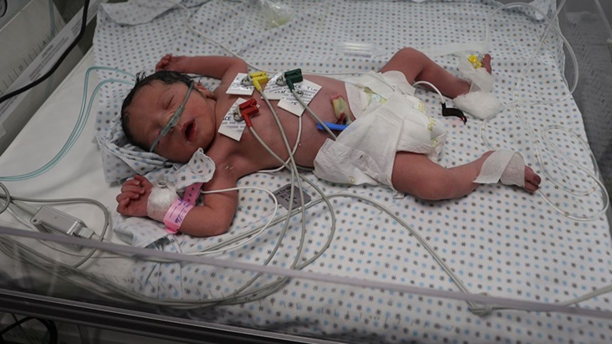 İsrail saldırısında ölen hamile annenin karnındaki bebek kurtarıldı