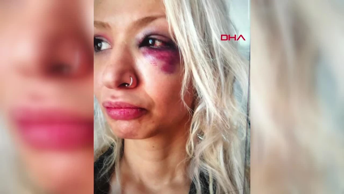 Şarkıcı Aybike Çelik, eski partneri Can Tunaboylu hakkında şiddet iddiasında bulundu