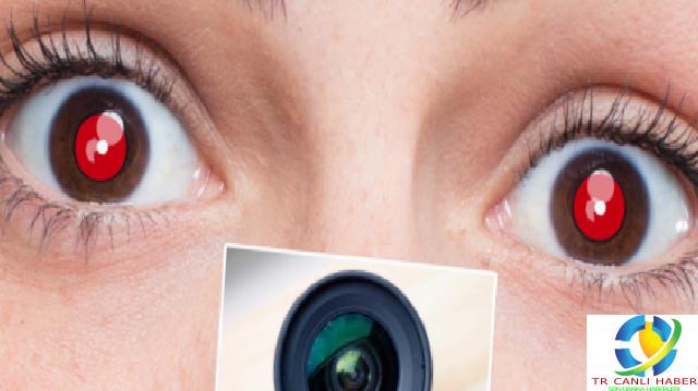 Fotoğraflarda gözlerin kırmızı gözükmesi ne anlama geliyor? Beyaz göz korkunç hastalığın işareti